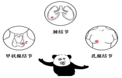 體檢查出結(jié)節(jié)，真的會(huì)癌變嗎？別慌，這樣處理就對(duì)了！